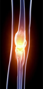 Knee Restoration Surgery